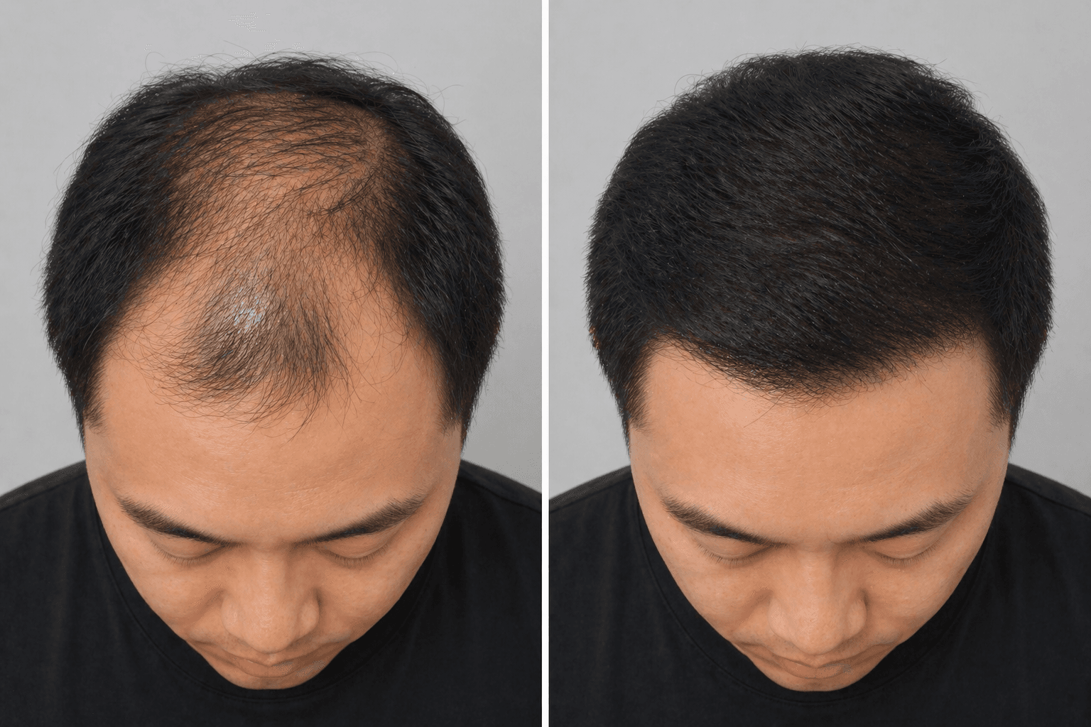 Hair Restoration & Wellness
